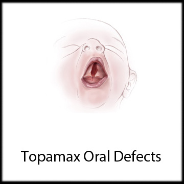 topamax_birth_defects_topamax_during_pregnancy_topamax_lawsuit_settlements_cleft_lip_clefte_palate